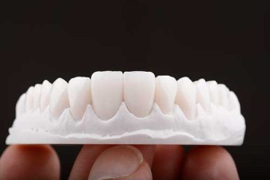 Pros And Cons Of Same-Day Dental Implants